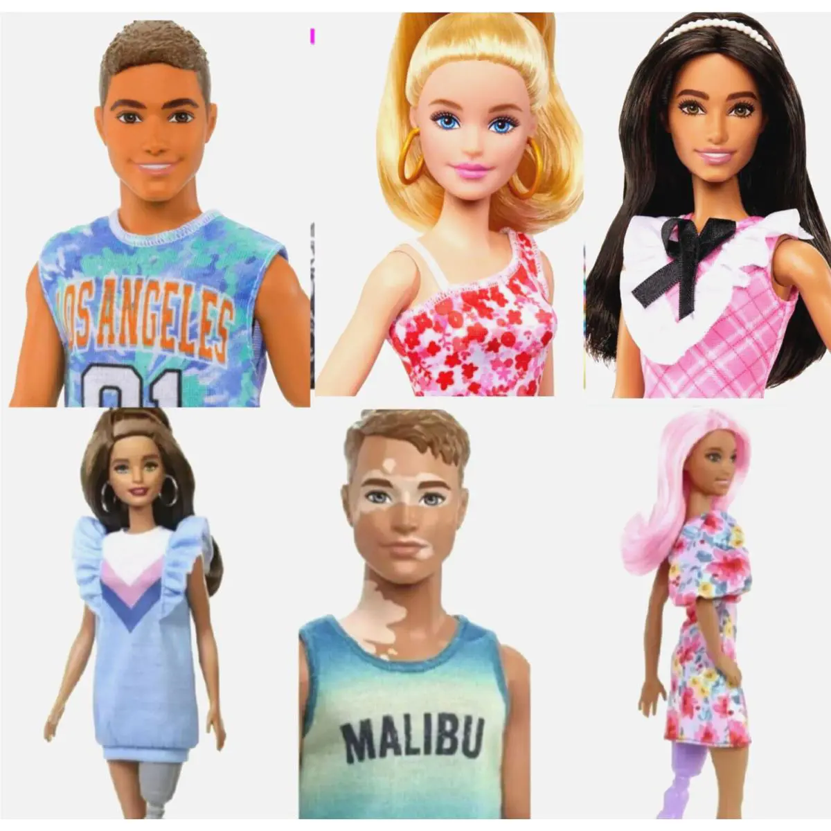 Barbie Fashionista Ken with Prosthetic Leg Vitiligo Bundle 6 Hybrid Sculpt Ooak